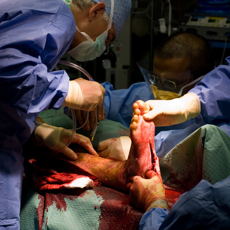 Supernumerary (detail)